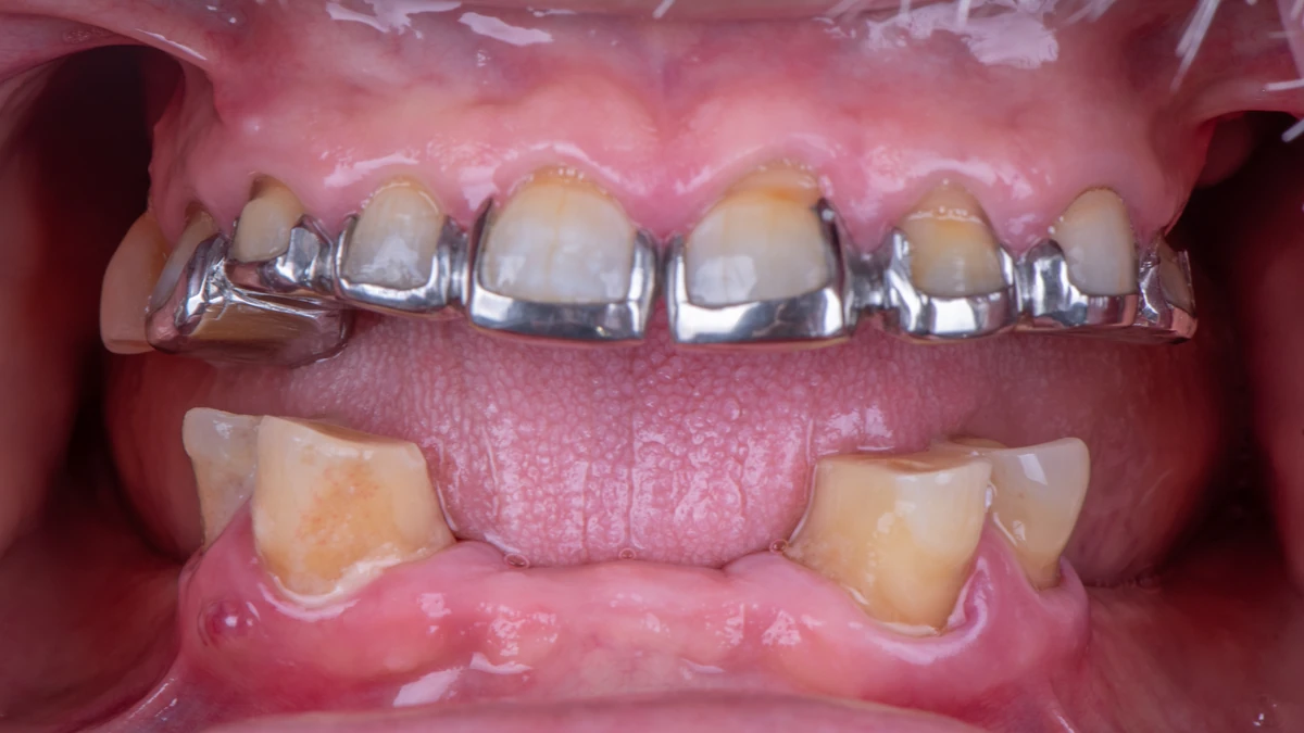 Before — Jorge's smile transformation