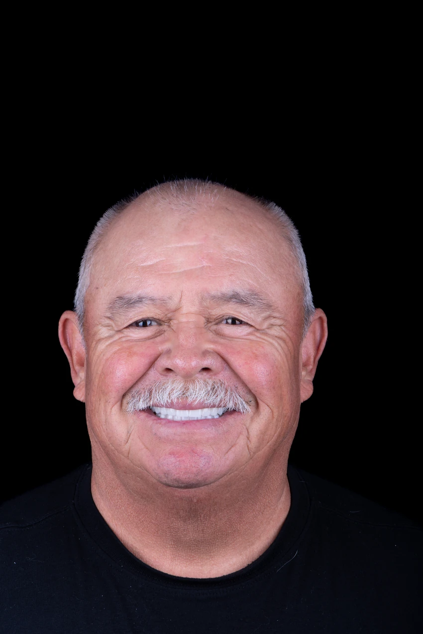 After — Jorge's smile transformation, portrait