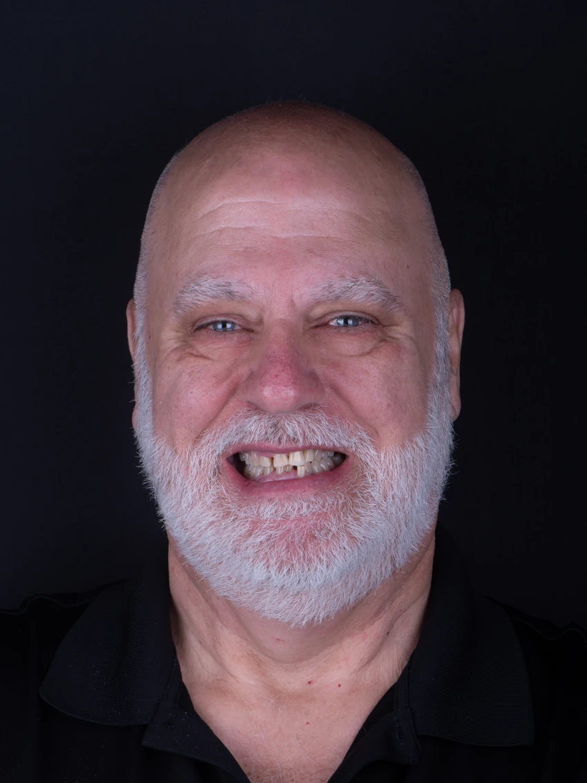Before — Steve's smile transformation, portrait