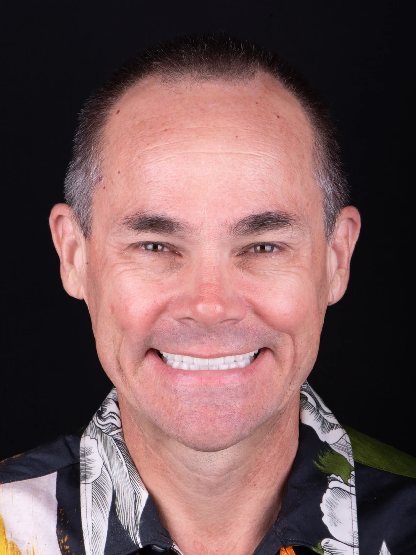 After — Complete smile transformation, portrait