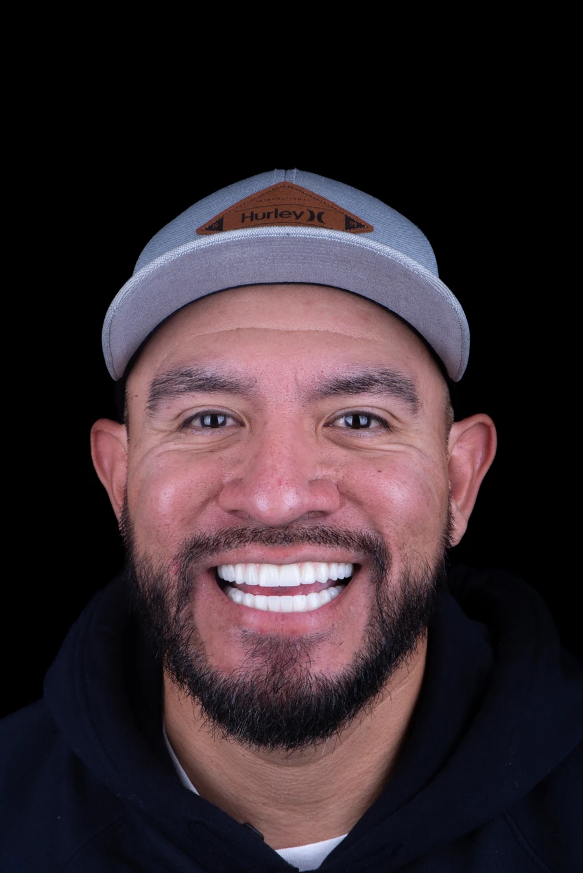 After — Complete smile transformation, portrait