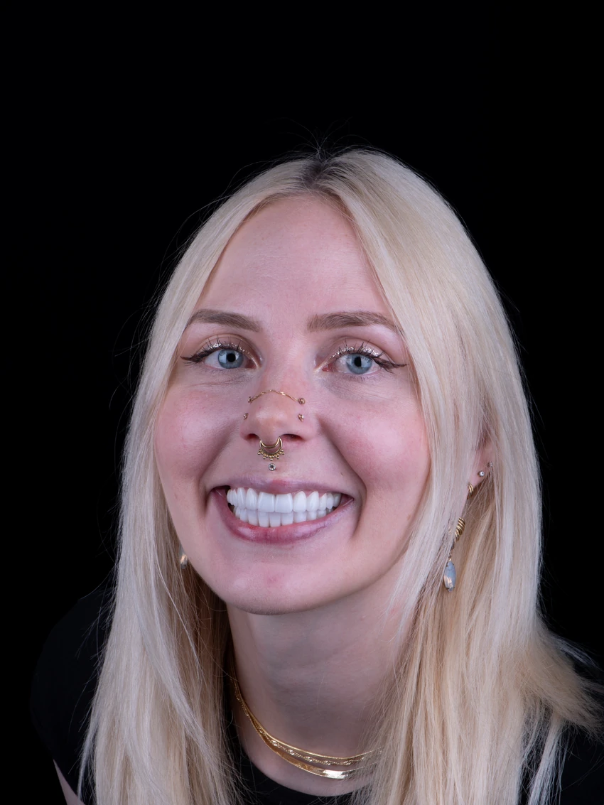 After — Complete smile transformation, portrait