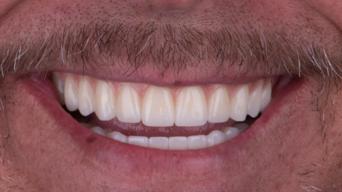 After — Jesus's smile transformation