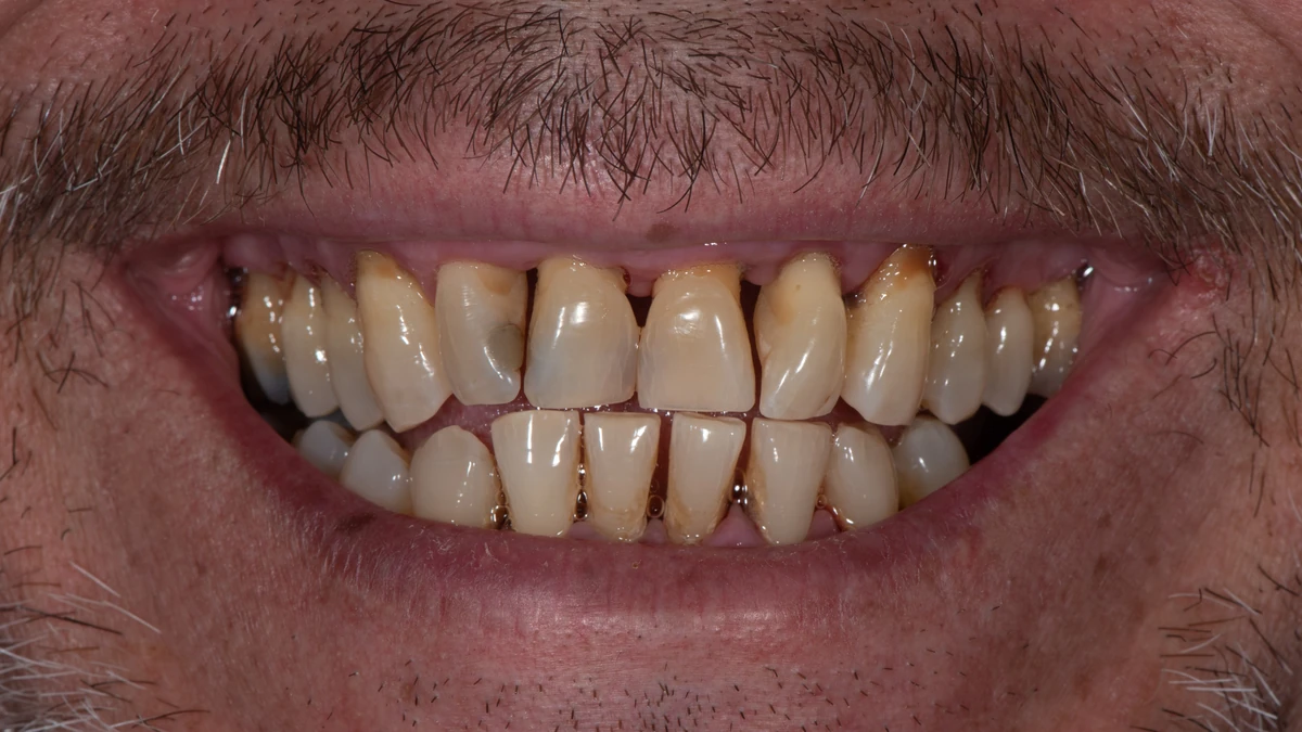Before — Jesus's smile transformation