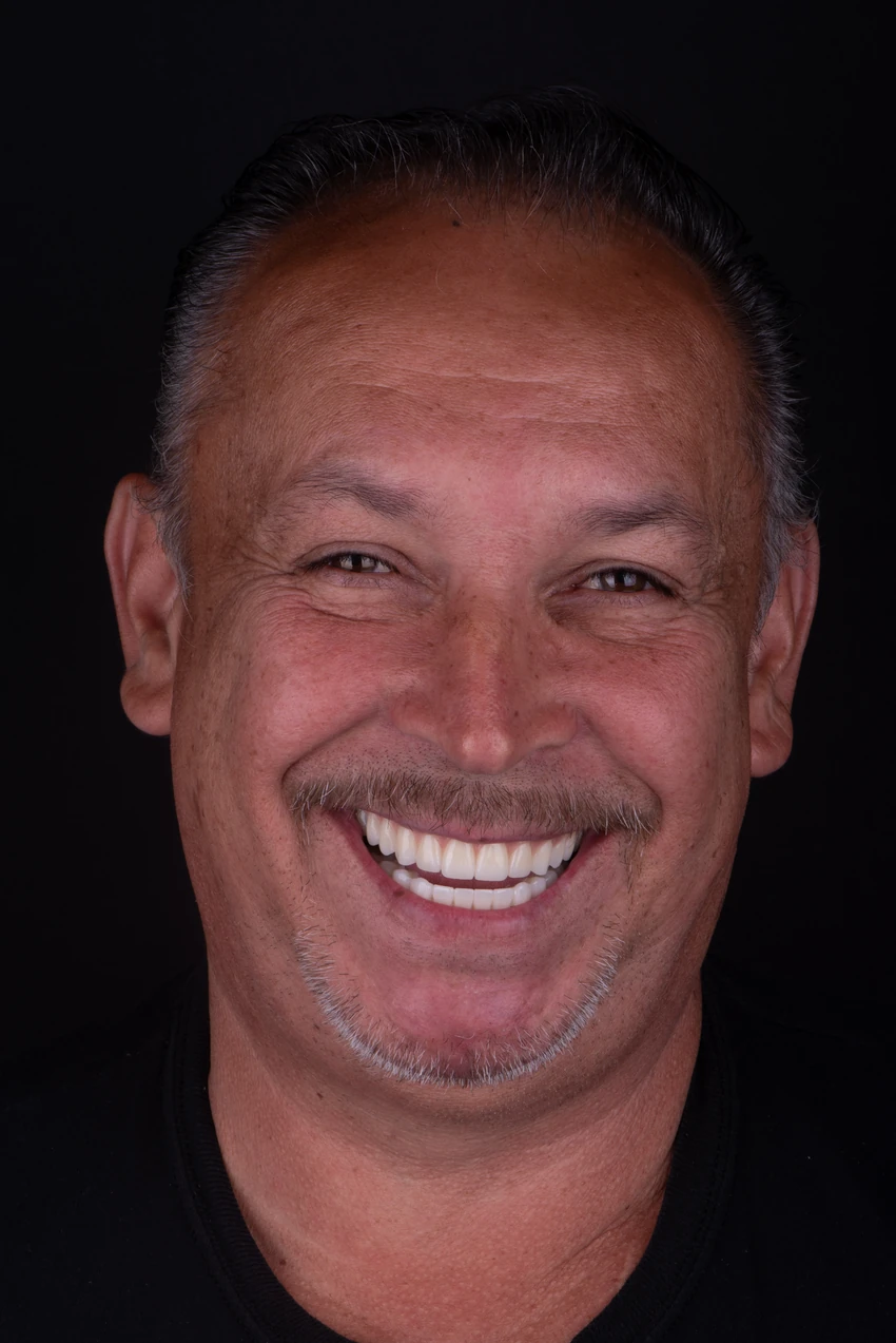 After — Jesus's smile transformation, portrait