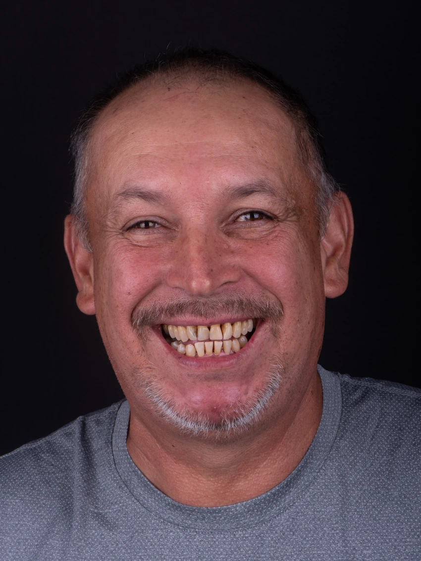 Before — Jesus's smile transformation, portrait