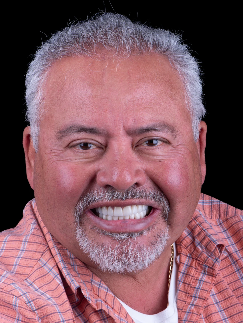 After — Complete smile transformation, portrait