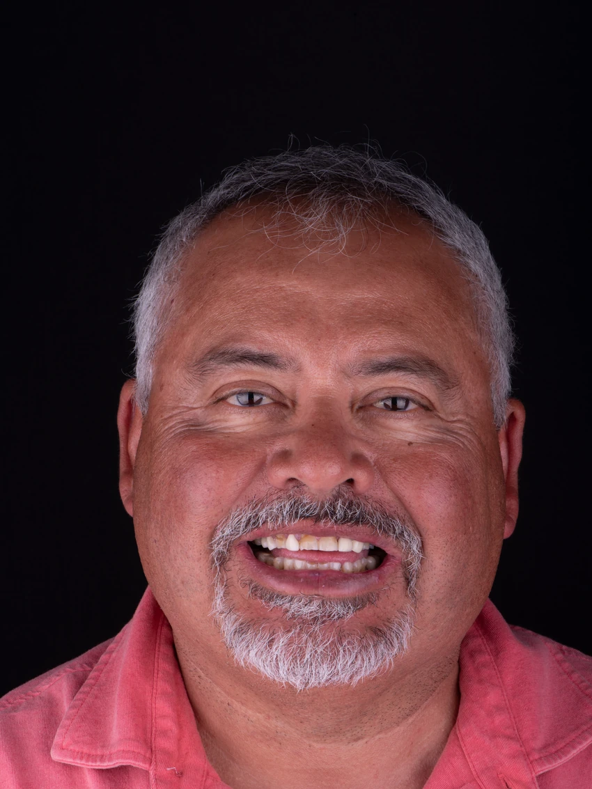 Before — Complete smile transformation, portrait