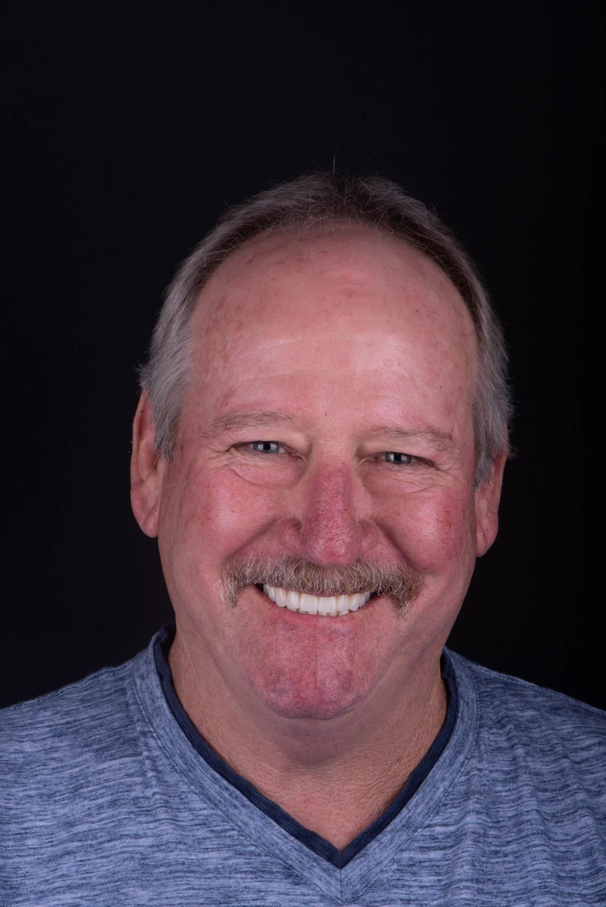 After — Michael's smile transformation, portrait