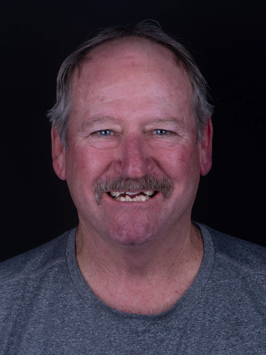 Before — Michael's smile transformation, portrait
