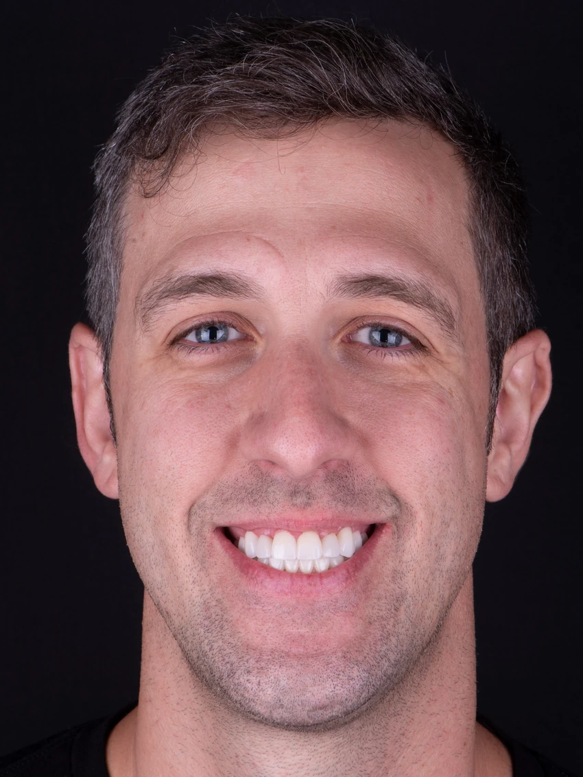 After — Patrick's smile transformation, portrait