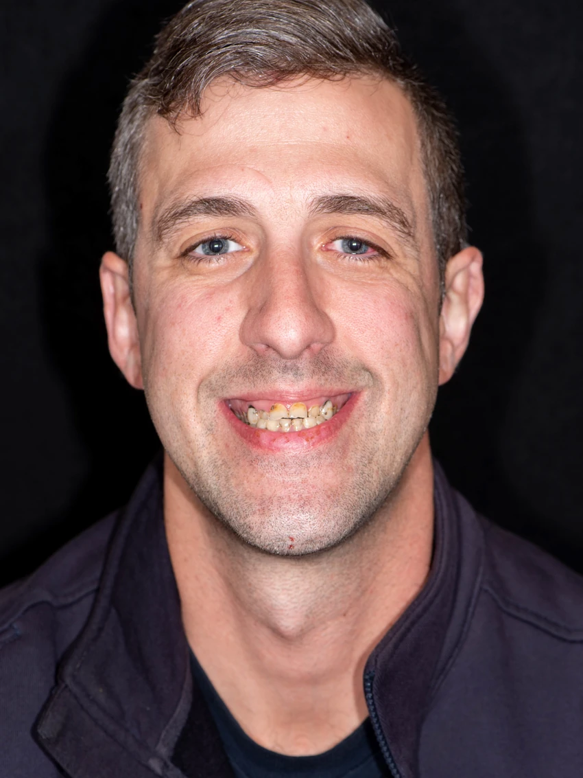 Before — Patrick's smile transformation, portrait