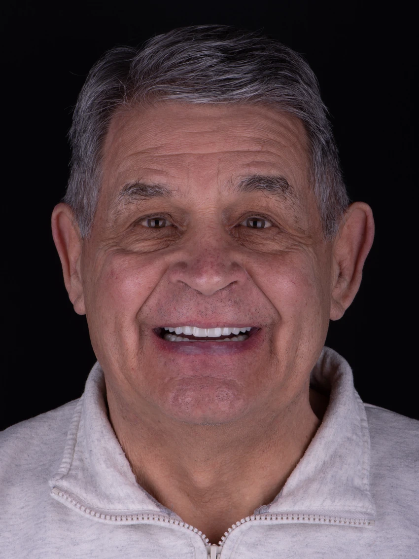 After — Joe's smile transformation, portrait