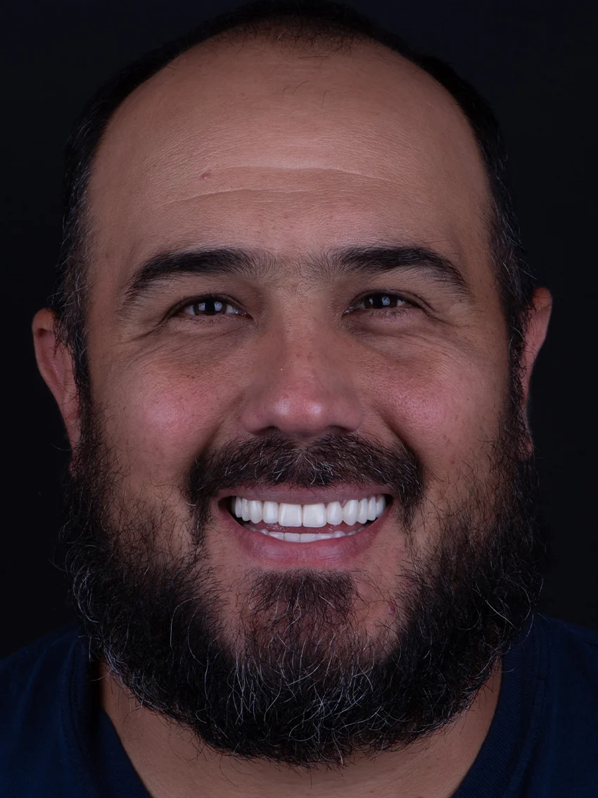After — Asa's smile transformation, portrait