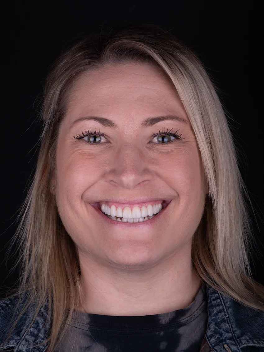 After — Briana's smile transformation, portrait