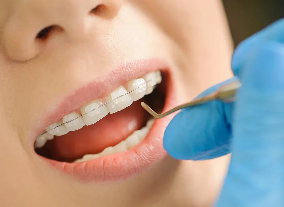 Revitalize Your Smile with Expert Prosthodontic Care