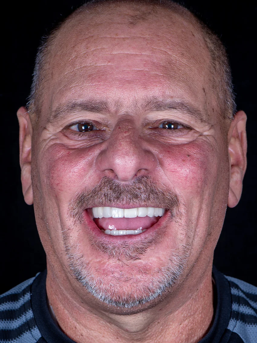 After — Ed's smile transformation, portrait