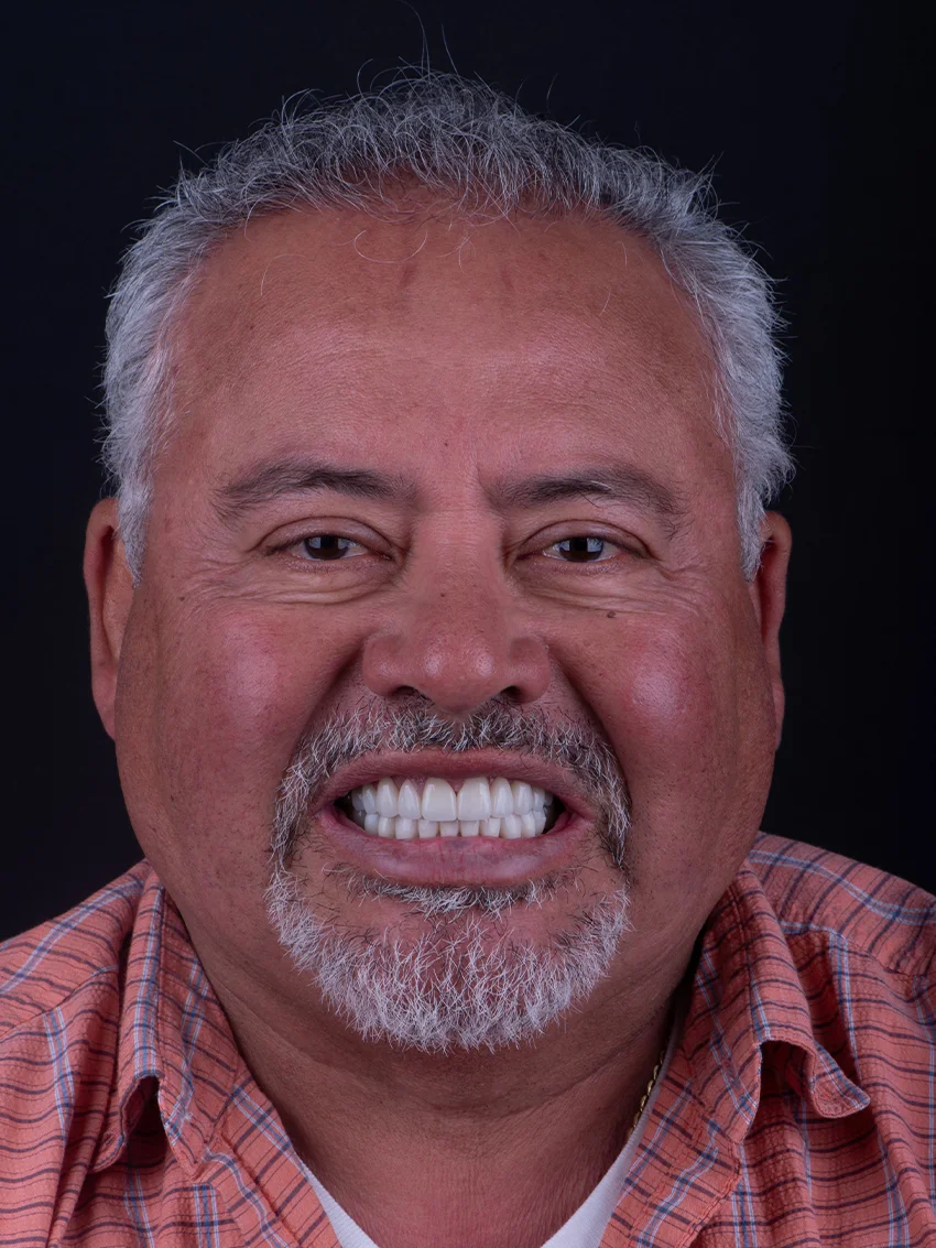 After — Manuel's smile transformation, portrait
