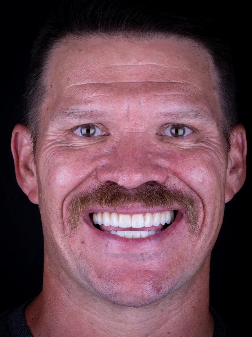After — Micah's smile transformation, portrait