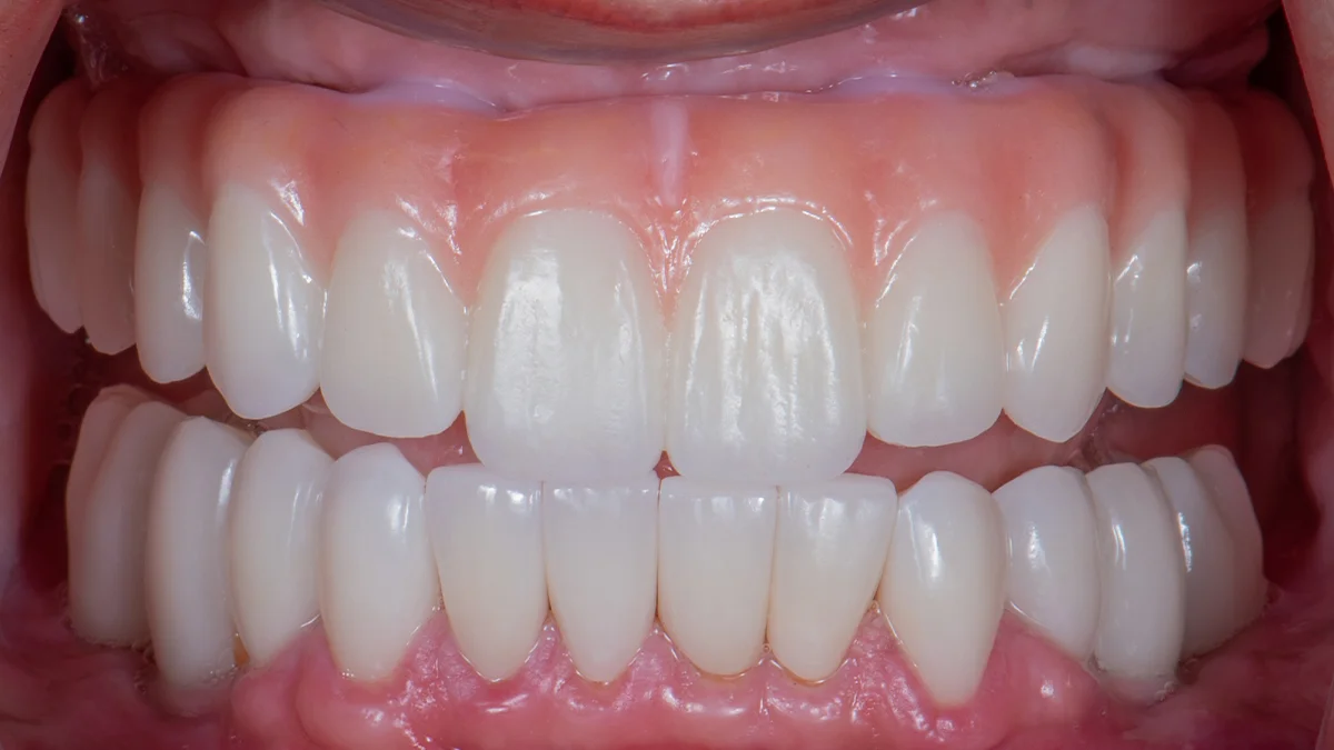 After — Miranda's smile transformation