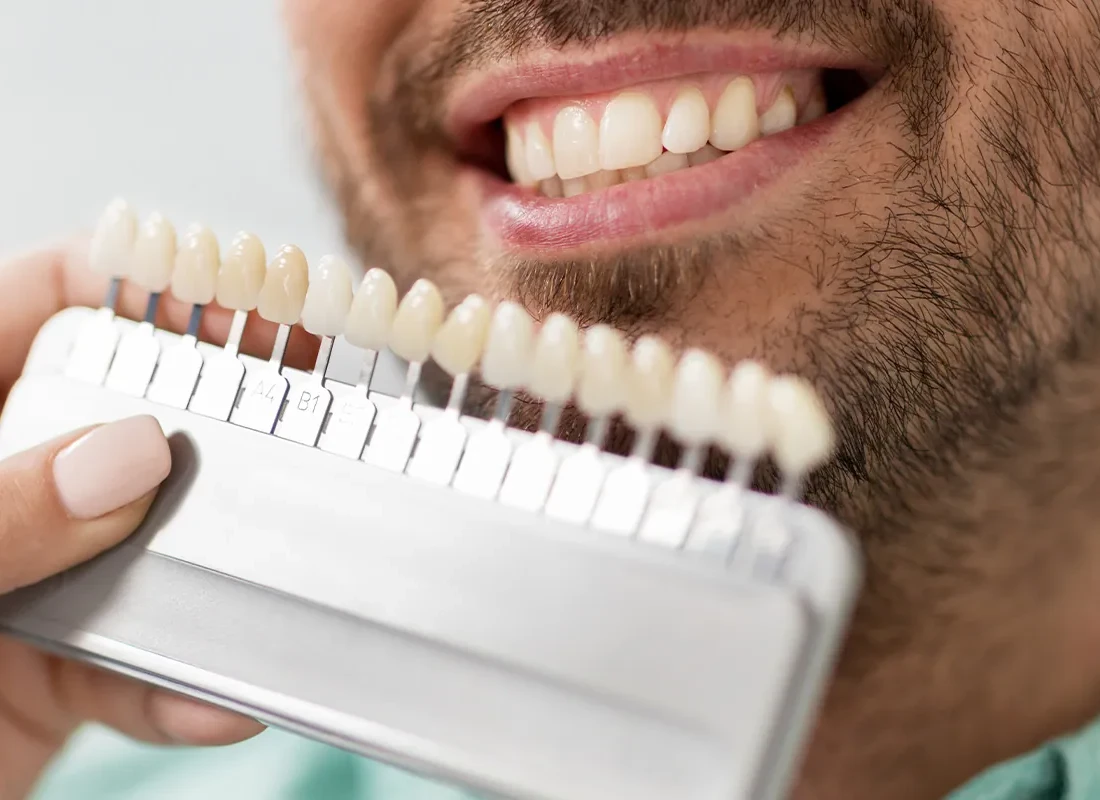 Brighten Your Smile: Expert Prosthodontist Tips for Teeth Whitening in Thousand Oaks, CA