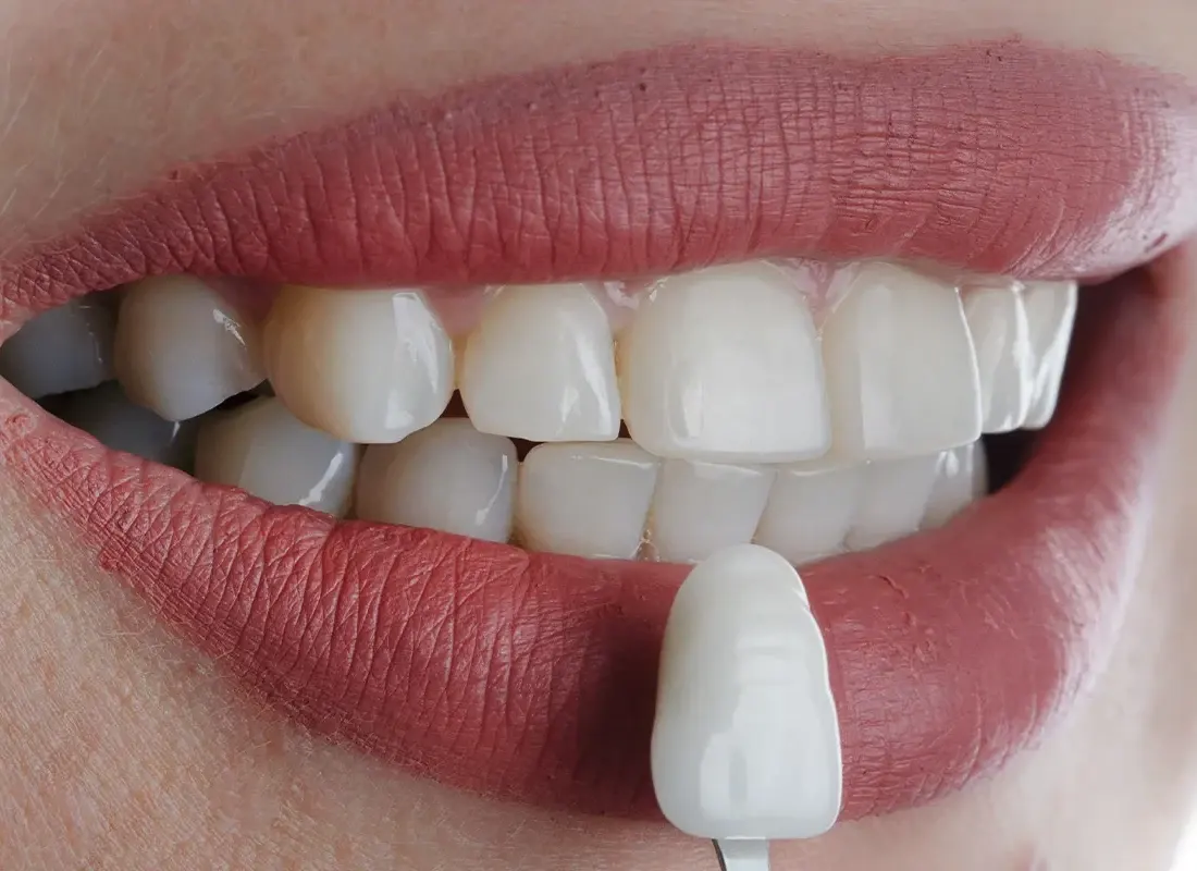 Transform Your Smile: The Role of a Prosthodontist in Advanced Cosmetic Dentistry