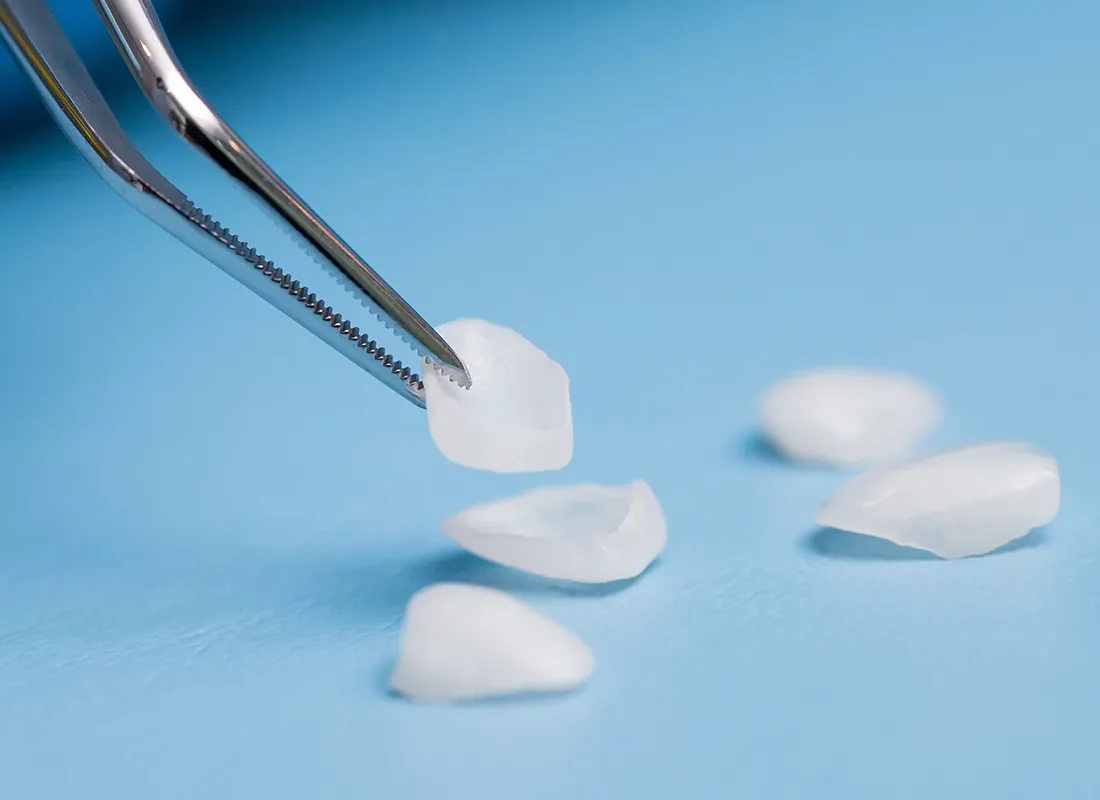 Every case checked against your smile design