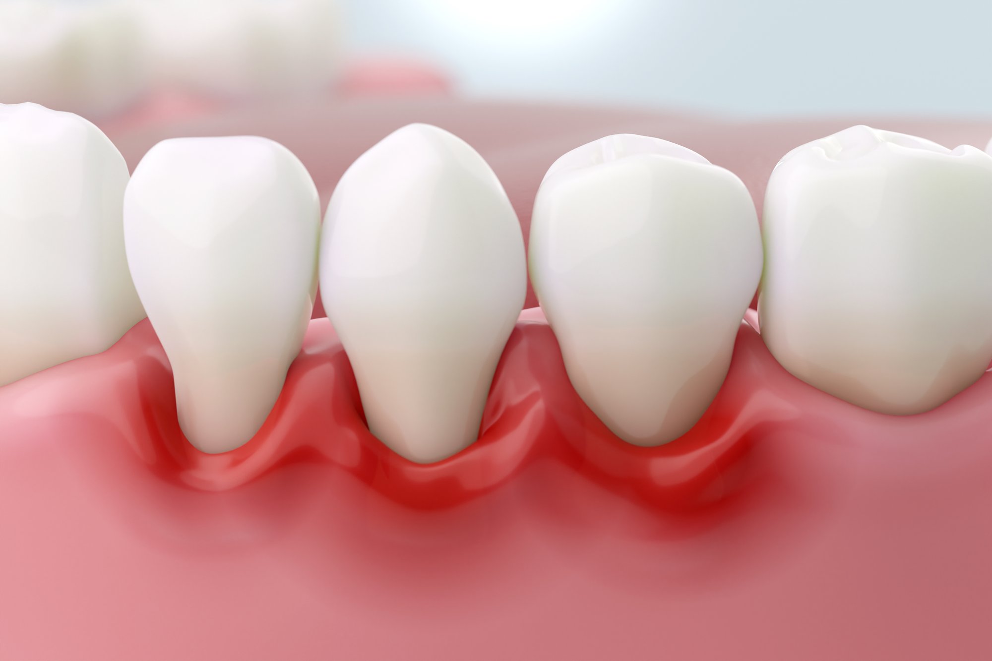 Top 5 Daily Habits for Healthy Gums in Thousand Oaks, CA