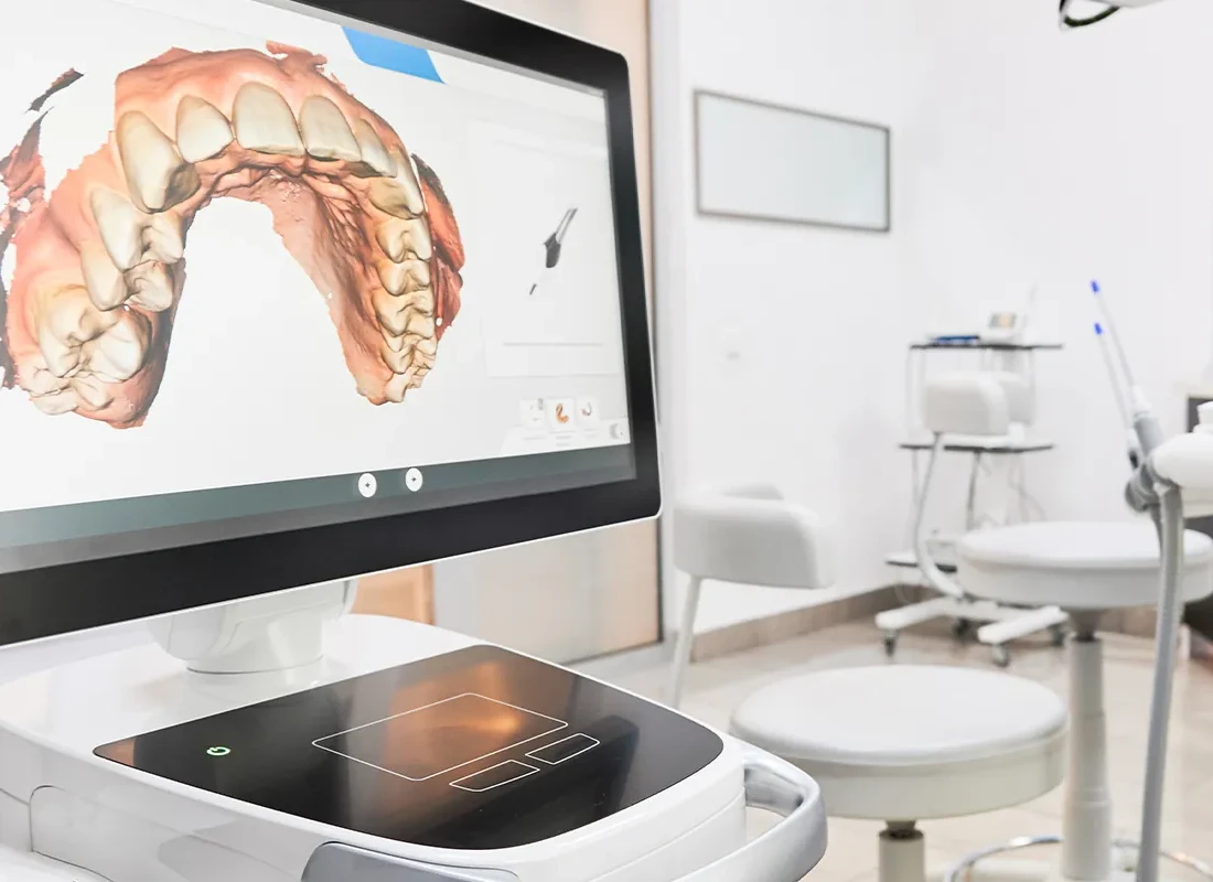 The benefits of Implant-Supported Dentures