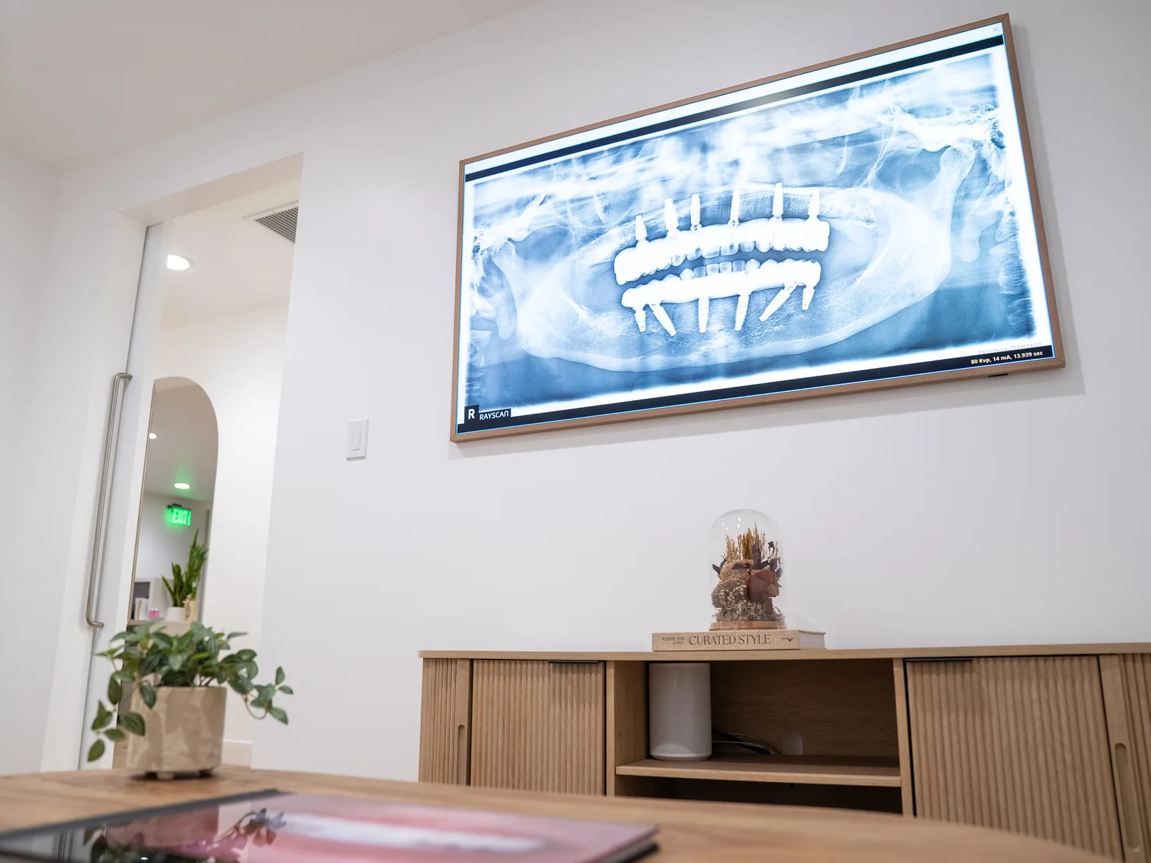 Inside Next Smile+Implant — Thousand Oaks, CA (5)