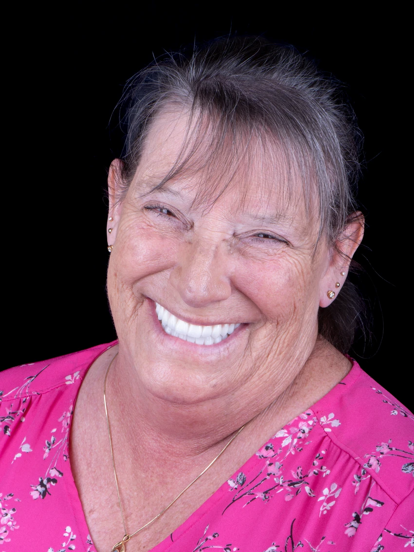 After — Complete smile transformation, portrait