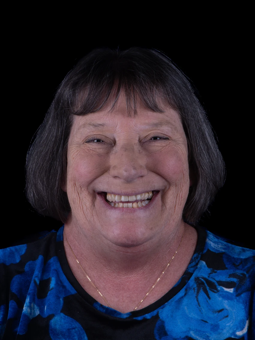 Before — Complete smile transformation, portrait