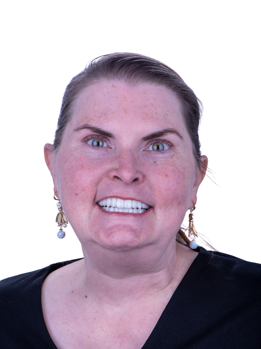 After — Complete smile transformation, portrait