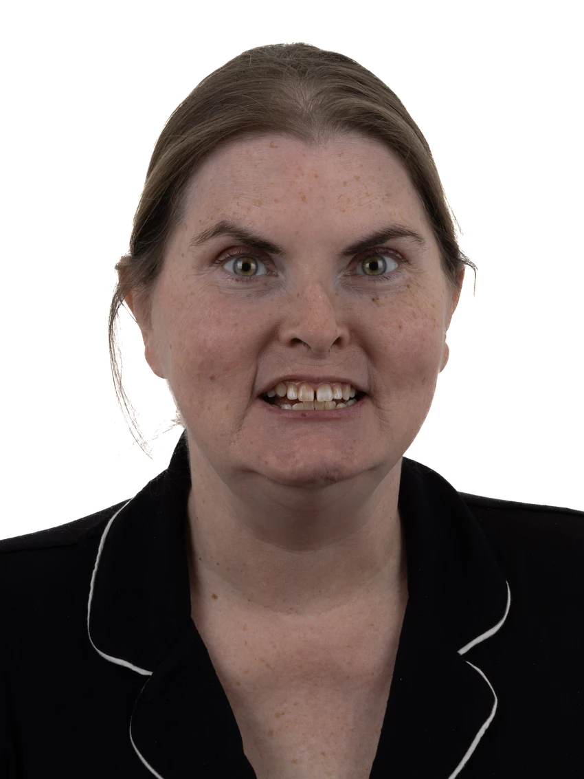 Before — Complete smile transformation, portrait