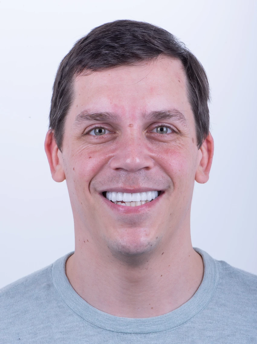 After — Complete smile transformation, portrait