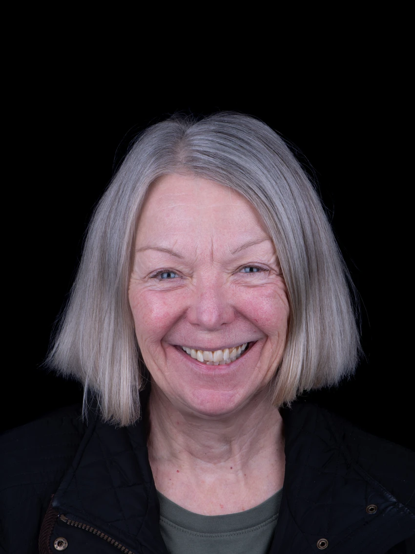 Before — Complete smile transformation, portrait