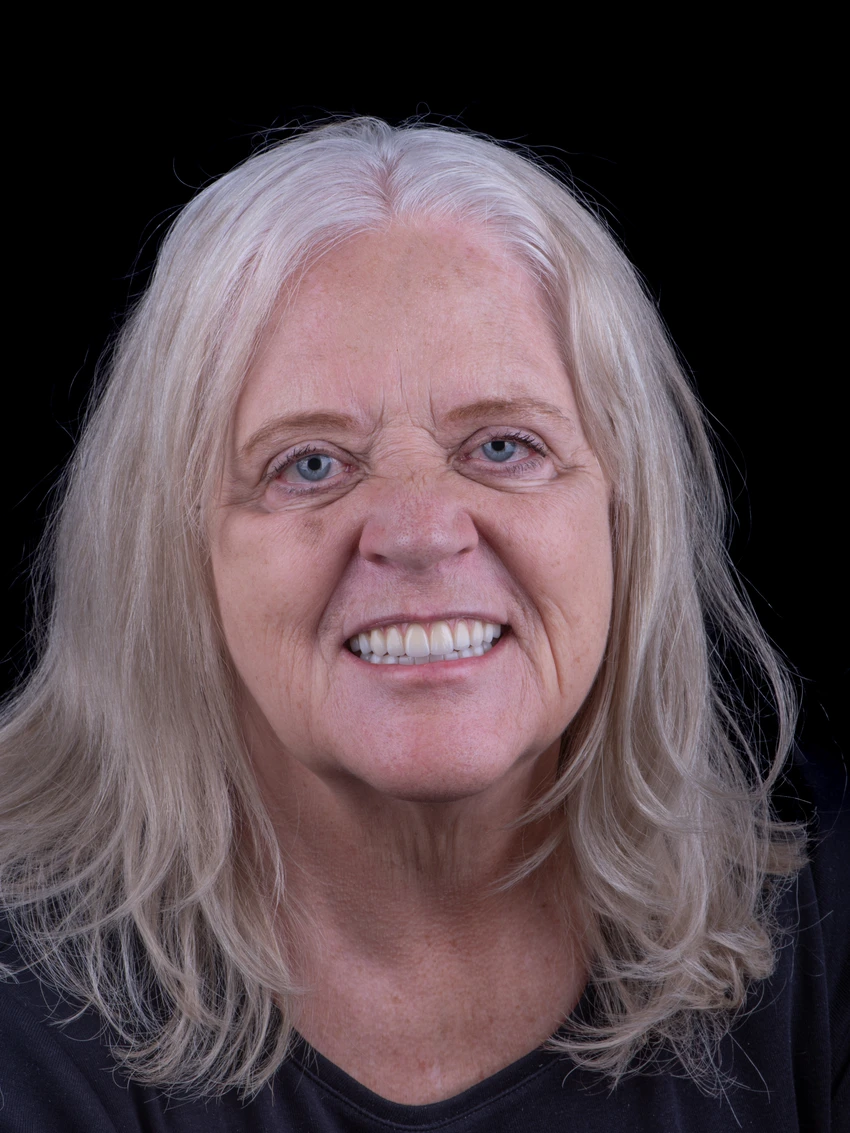 After — Complete smile transformation, portrait