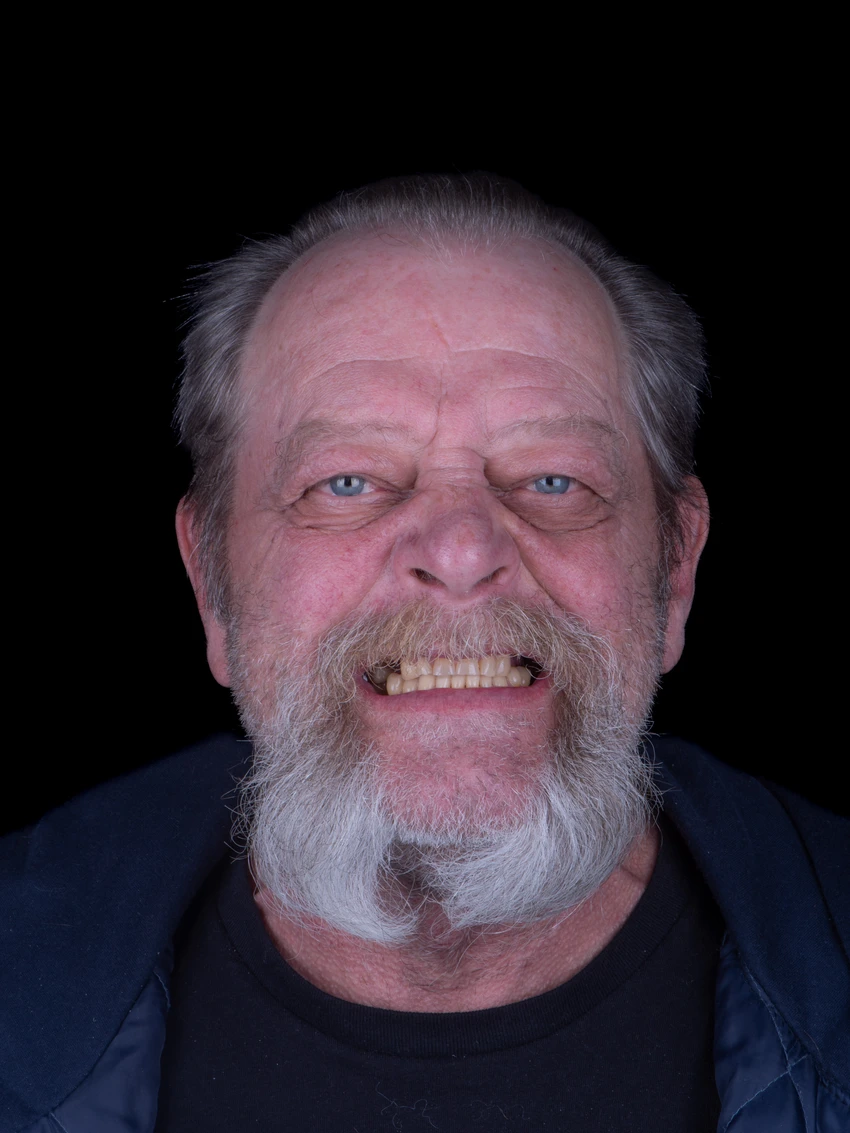 Before — Complete smile transformation, portrait