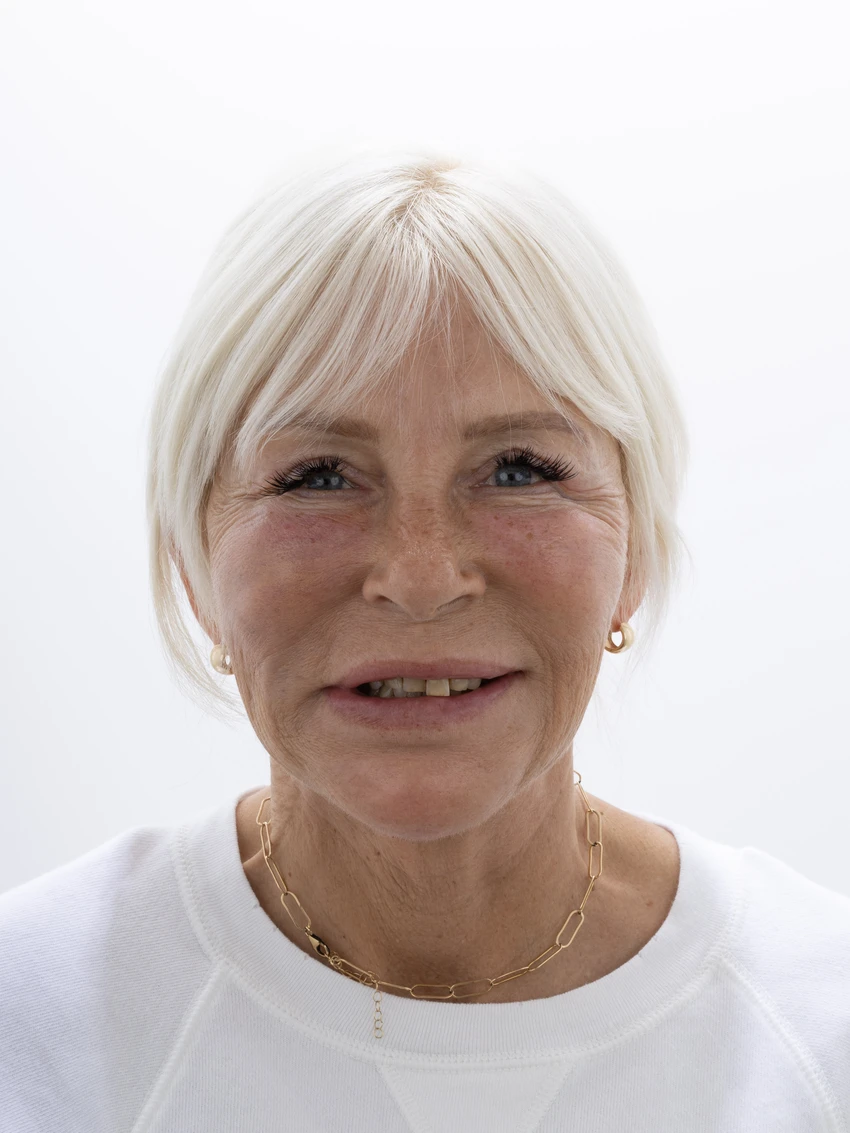 Before — Complete smile transformation, portrait