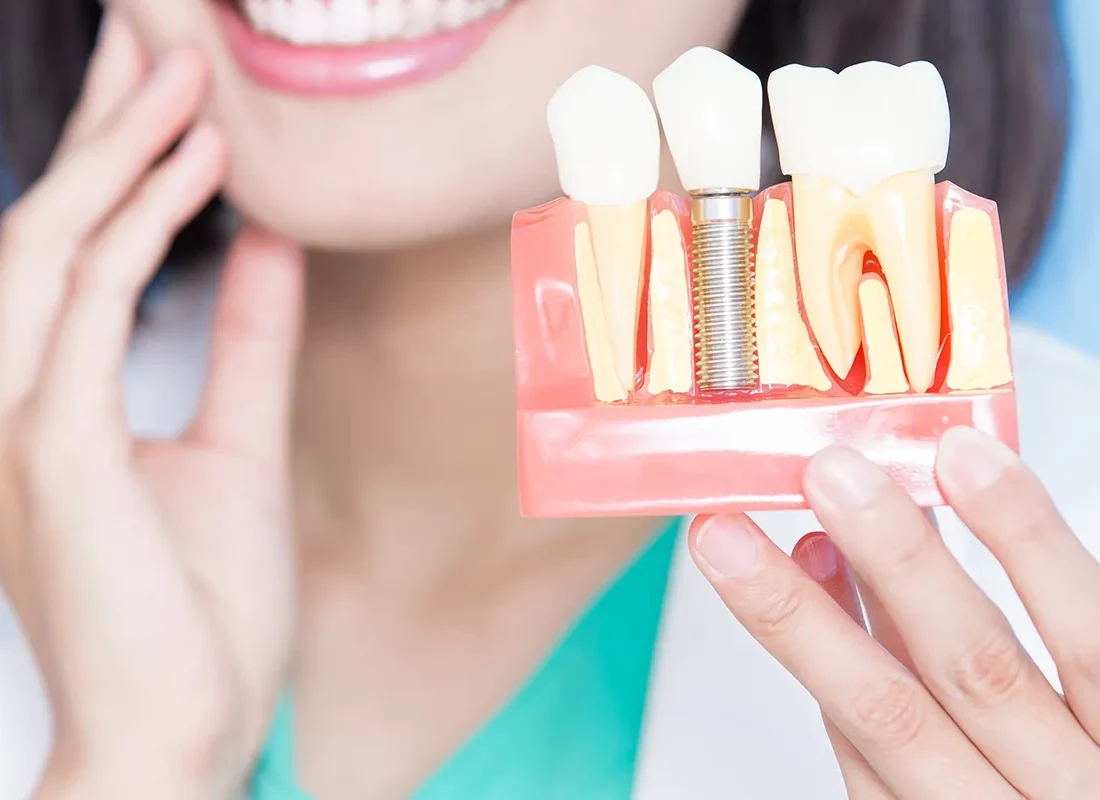 Dental Implants: Are In Plants Teeth Right For You?