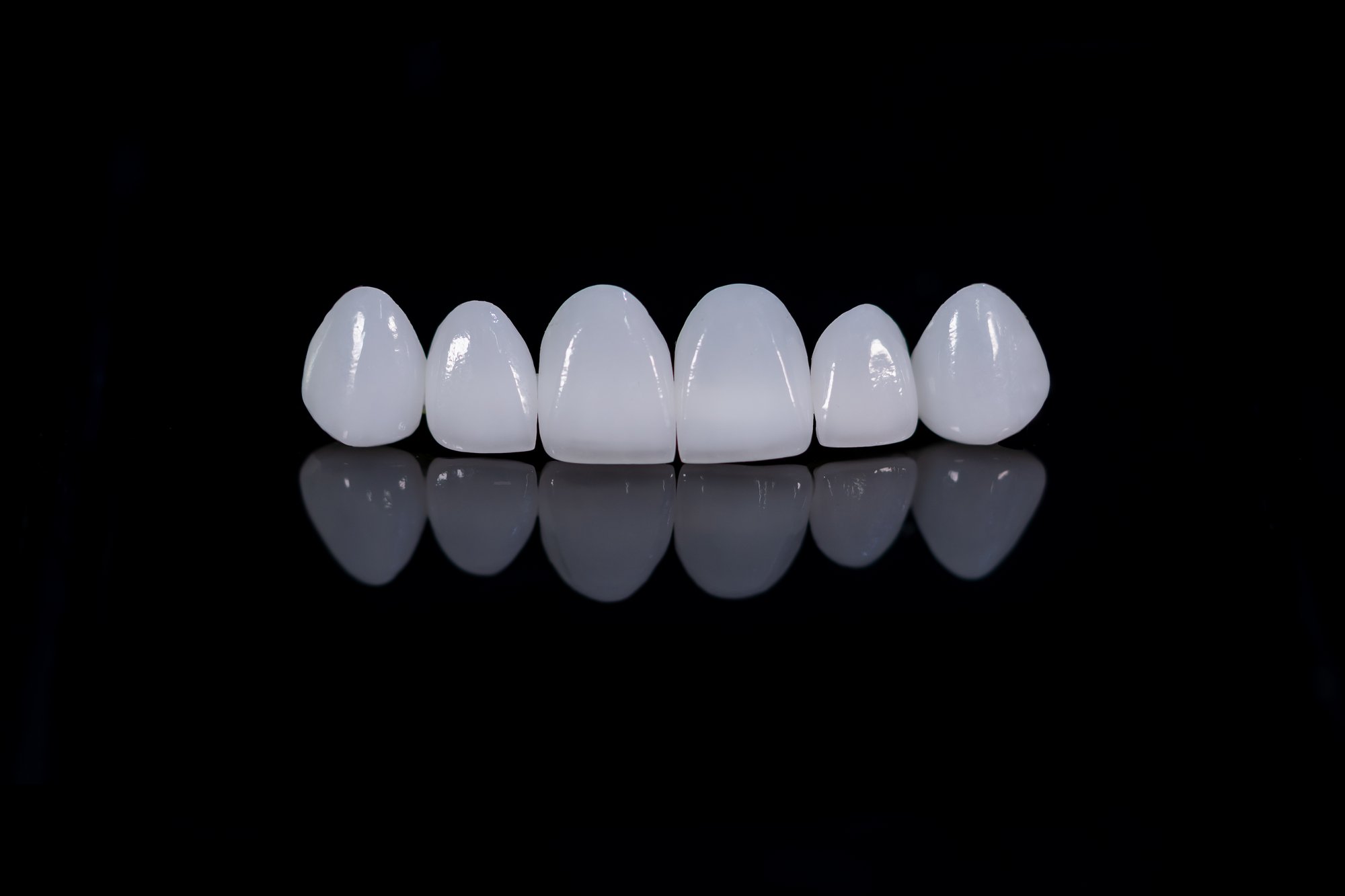 Will Veneers Harm My Real Teeth?