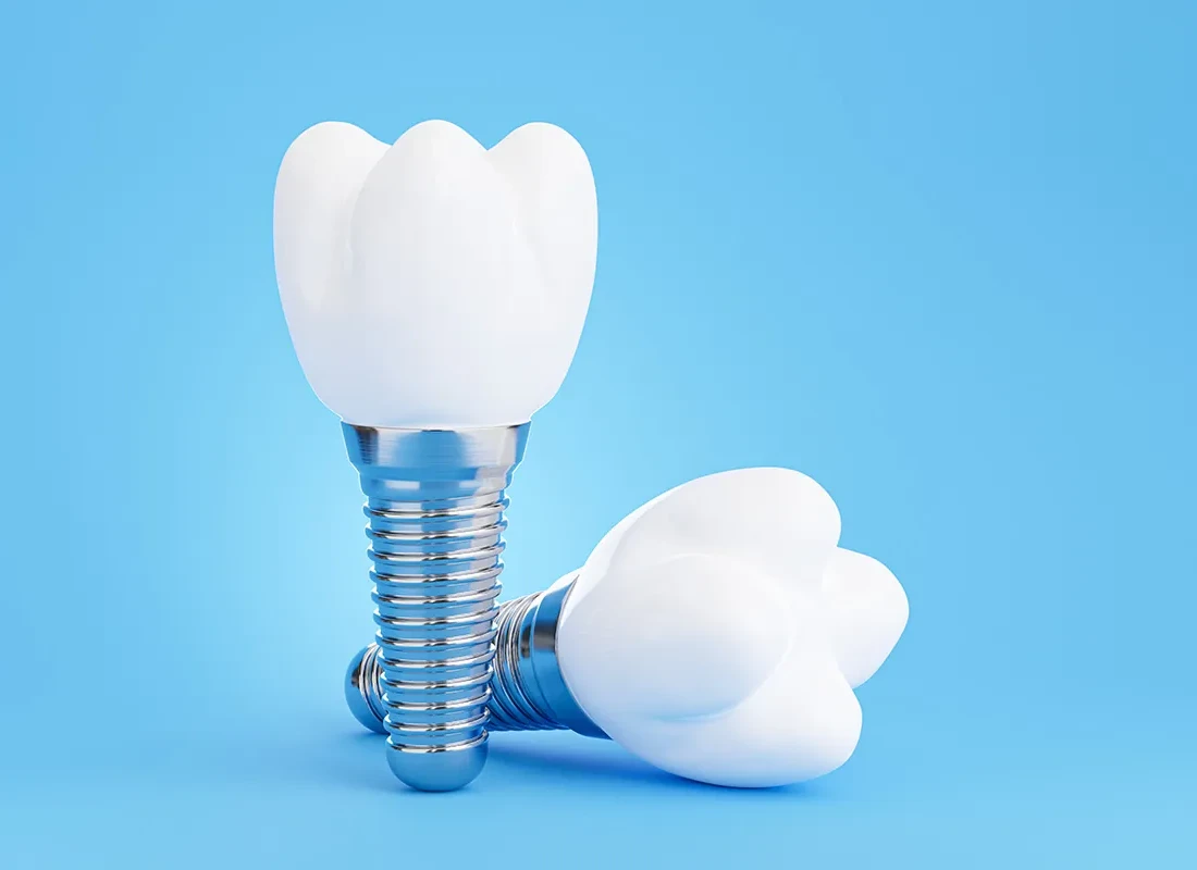 Dental Implants: A Strong, Natural-Feeling Replacement For Missing Teeth